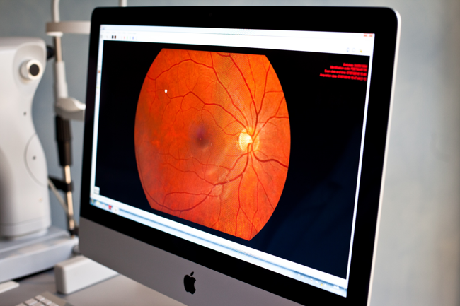 Monitorare la salute della cornea e della retina attraverso la Tomografia a Coerenza Ottica (OCT)